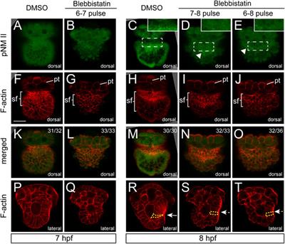 Nonmuscle Myosin II is Required for Larval Shell Formation in a Patellogastropod